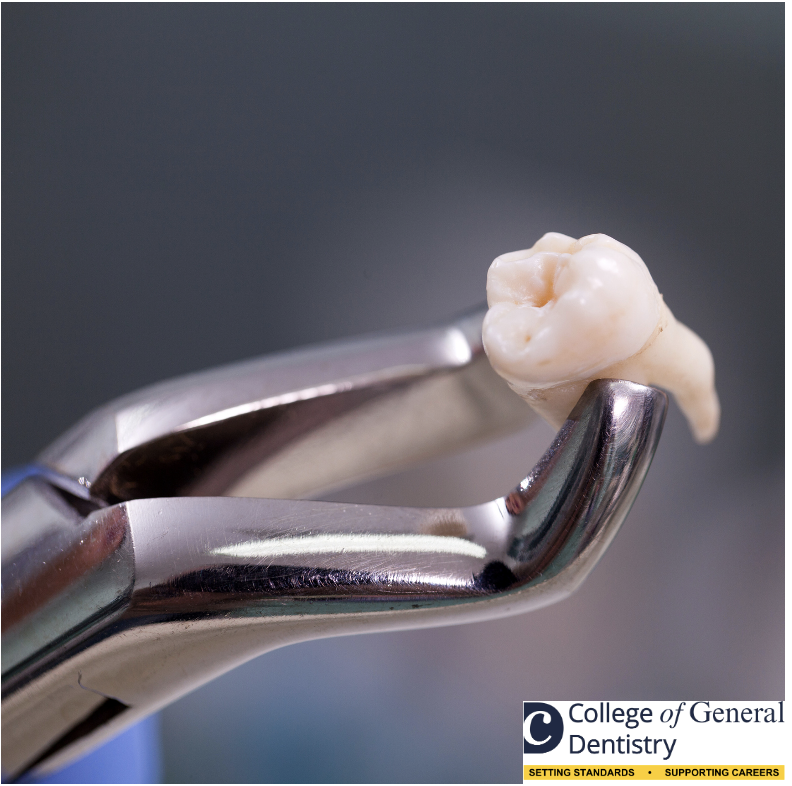 P100 Making Dental Extractions Predictable: A Methodological Approach thumbnail