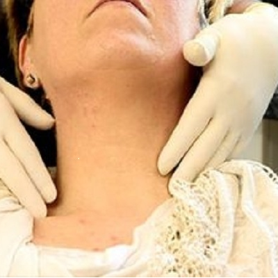Image representing P698 Detecting Oral Cancer