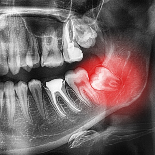 Image representing P699 Oral Surgery Examination