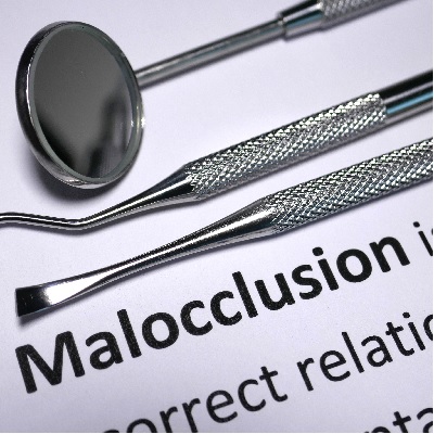 P130 Malocclusion and Orthodontic Treatment: Psychosocial Outcomes thumbnail