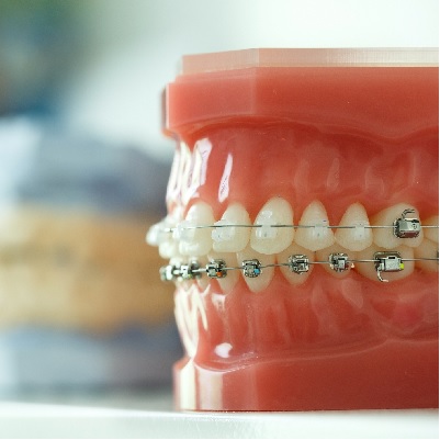 Image representing P197 Orthodontic Assessment for GDPs 