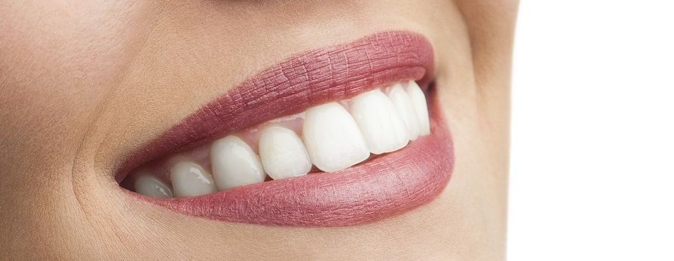Image representing Rising number of adults seeking orthodontic treatment in the UK