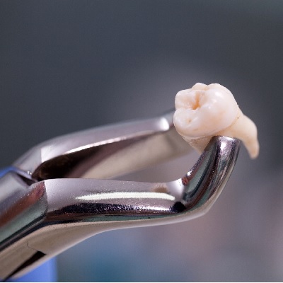 Image representing P100 Making Dental Extractions Predictable: A Methodological Approach