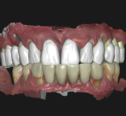 Image representing P398 Exploring Possibilities With PolyJet Technology in Digital Dentistry
