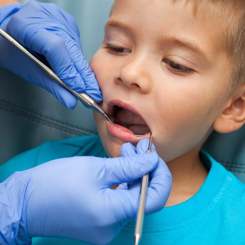 Image representing P399 A Review of Common Oral Medicine Conditions in Children